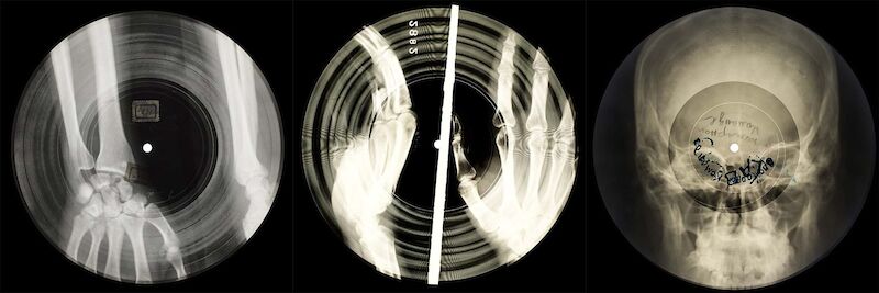 Repurposed x-ray film used to create illicit flexi records.